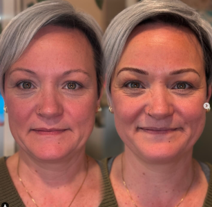 Before & After Permanent Cosmetics